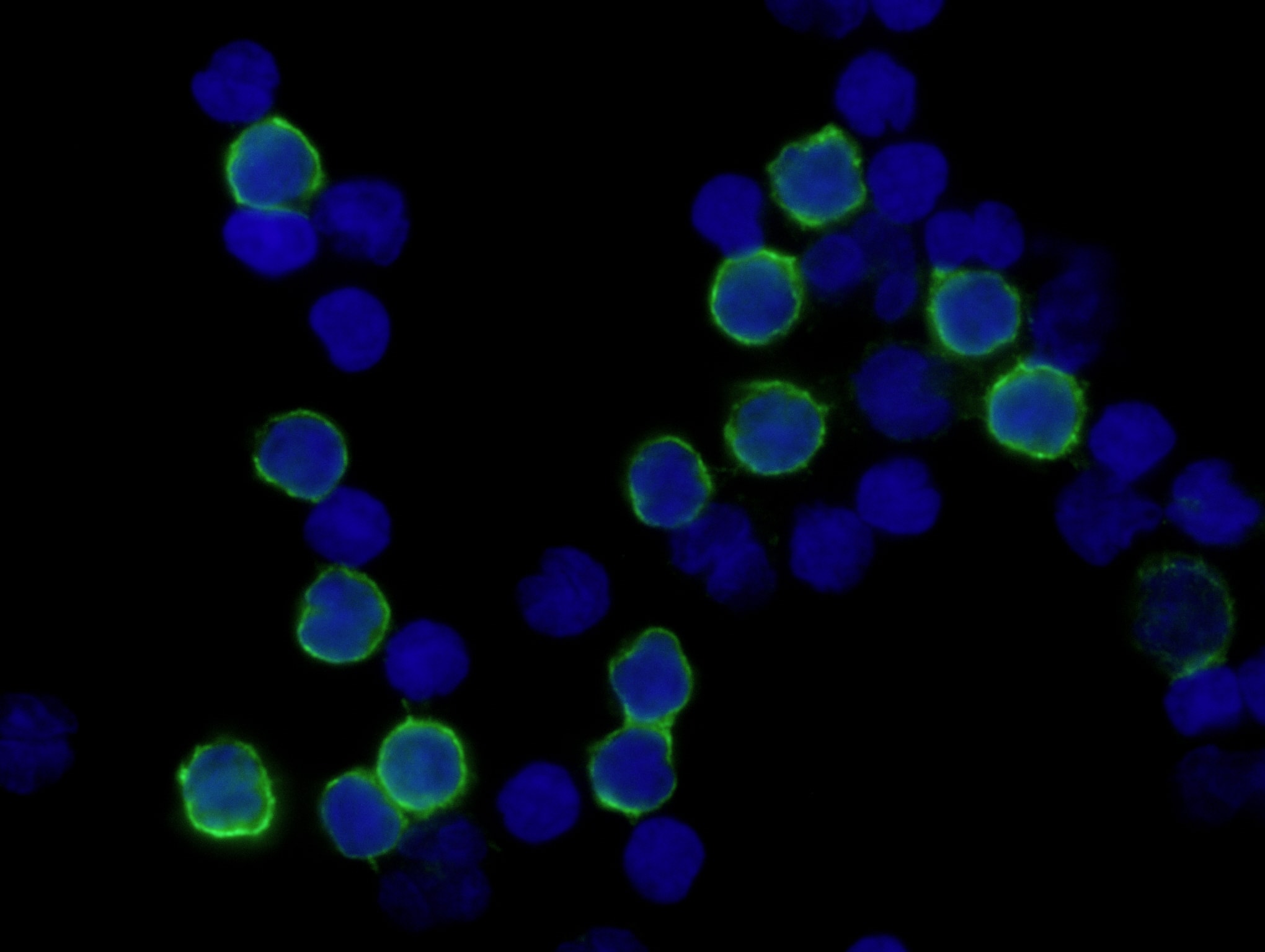 CD4 was detected in immersion fixed human peripheral blood mononuclear cells (PBMCs) using Mouse Anti-Human CD4 Monoclonal Antibody (Catalog # MAB379) at 10 µg/mL for 3 hours at room temperature. Cells were stained using the NorthernLights™ 493-conjugated Anti-Mouse IgG Secondary Antibody (green; Catalog # NL009) and counterstained with DAPI(blue). Specific staining was localized to the cell surface. View our protocol for Fluorescent ICC Staining of Non-adherent Cells.