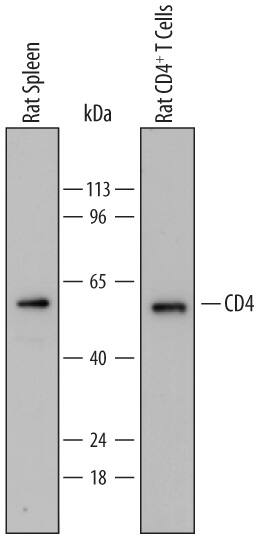 Western blot shows lysates of rat spleen tissue and rat CD4+T Cells. PVDF membrane was probed with 0.2 µg/mL of Mouse Anti-Rat CD4 Monoclonal Antibody (Catalog # MAB6439) followed by HRP-conjugated Anti-Mouse IgG Secondary Antibody (Catalog # HAF018). A specific band was detected for CD4 at approximately 55 kDa (as indicated). This experiment was conducted under reducing conditions and using Immunoblot Buffer Group 1.