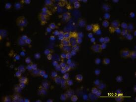 CD55/DAF was detected in immersion fixed human peripheral blood mononuclear cells (PBMCs) using Goat Anti-Human CD55/DAF Biotinylated Antigen Affinity-purified Polyclonal Antibody (Catalog # BAF2009) at 10 µg/mL for 3 hours at room temperature. Cells were stained using the NorthernLights™ 557-conjugated Streptavidin (yellow; Catalog # NL999) and counterstained with DAPI (blue). View our protocol for Fluorescent ICC Staining of Non-adherent Cells.