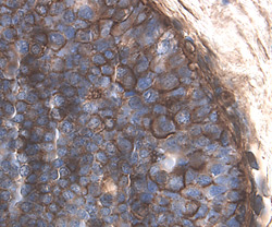 CD59 was detected in immersion fixed paraffin-embedded sections of human breast using 1.7 µg/mL Goat Anti-Human CD59 Antigen Affinity-purified Polyclonal Antibody (Catalog # AF1987) overnight at 4 °C. Tissue was stained with the Anti-Goat HRP-DAB Cell & Tissue Staining Kit (brown; Catalog # CTS008) and counterstained with hematoxylin (blue). View our protocol for Chromogenic IHC Staining of Paraffin-embedded Tissue Sections.