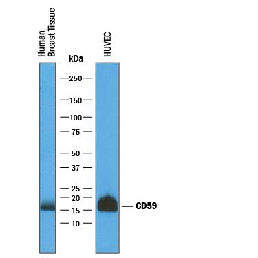 Western blot shows lysates of human breast tissue and HUVEC human umbilical vein endothelial cells. PVDF membrane was probed with 1 µg/mL of Goat Anti-Human CD59 Antigen Affinity-purified Polyclonal Antibody (Catalog # AF1987) followed by HRP-conjugated Anti-Goat IgG Secondary Antibody (Catalog # HAF019). A specific band was detected for CD59 at approximately 16 kDa (as indicated). This experiment was conducted under reducing conditions and using Immunoblot Buffer Group 1.
