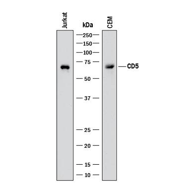 Western blot shows lysates of Jurkat human acute T cell leukemia cell line and CEM human T-lymphoblastoid cell line. PVDF membrane was probed with 0.5 µg/mL of Goat Anti-Human CD5 Antigen Affinity-purified Polyclonal Antibody (Catalog # AF1636) followed by HRP-conjugated Anti-Goat IgG Secondary Antibody (Catalog # HAF017). A specific band was detected for CD5 at approximately 67 kDa (as indicated). This experiment was conducted under reducing conditions and using Immunoblot Buffer Group 1.