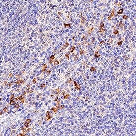 CD5 was detected in immersion fixed paraffin-embedded sections of human tonsil using Mouse Anti-Human CD5 Monoclonal Antibody (Catalog # MAB16361) at 5 µg/mL for 1 hour at room temperature followed by incubation with the Anti-Mouse IgG VisUCyte™ HRP Polymer Antibody (Catalog # VC001). Before incubation with the primary antibody, tissue was subjected to heat-induced epitope retrieval using Antigen Retrieval Reagent-Basic (Catalog # CTS013). Tissue was stained using DAB (brown) and counterstained with hematoxylin (blue). Specific staining was localized to cell surfaces in lymphocytes. View our protocol for IHC Staining with VisUCyte HRP Polymer Detection Reagents.
