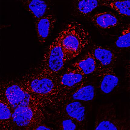 CD63 was detected in immersion fixed A431 human epithelial carcinoma cell line using Rabbit Anti-Human CD63 Monoclonal Antibody (Catalog # MAB50481) at 3 µg/mL for 3 hours at room temperature. Cells were stained using the NorthernLights™ 557-conjugated Anti-Rabbit IgG Secondary Antibody (red; Catalog # NL004) and counterstained with DAPI (blue). Specific staining was localized to cytoplasm and cell surface. View our protocol for Fluorescent ICC Staining of Cells on Coverslips.