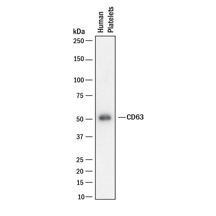 Western blot shows lysates of human platelets. PVDF membrane was probed with 0.5 µg/mL of Rabbit Anti-Human CD63 Monoclonal Antibody (Catalog # MAB50482) followed by HRP-conjugated Anti-Rabbit IgG Secondary Antibody (HAF008). A specific band was detected for CD63 at approximately 55 kDa (as indicated). This experiment was conducted under reducing conditions and using Immunoblot Buffer Group 1.