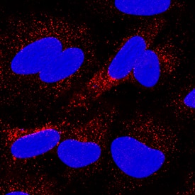CD63 was detected in immersion fixed A549 human lung carcinoma cell line using Mouse Anti-Human CD63 Monoclonal Antibody (Catalog # MAB5048) at 25 µg/mL for 3 hours at room temperature. Cells were stained using the NorthernLights™ 557-conjugated Anti-Mouse IgG Secondary Antibody (red; NL007) and counterstained with DAPI (blue). Specific staining was localized to cytoplasm. View our protocol for Fluorescent ICC Staining of Cells on Coverslips.