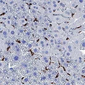CD68/SR-D1 was detected in immersion fixed paraffin-embedded sections of mouse liver using Rabbit Anti-Mouse CD68/SR-D1 Monoclonal Antibody (Catalog # MAB101141) at 3 µg/mL for 1 hour at room temperature followed by incubation with the Anti-Rabbit IgG VisUCyte™ HRP Polymer Antibody (Catalog # VC003). Before incubation with the primary antibody, tissue was subjected to heat-induced epitope retrieval using Antigen Retrieval Reagent-Basic (Catalog # CTS013). Tissue was stained using DAB (brown) and counterstained with hematoxylin (blue). Specific staining was localized to Kupffer cells. View our protocol for IHC Staining with VisUCyte HRP Polymer Detection Reagents.