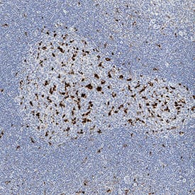 CD68/SR-D1 was detected in immersion fixed paraffin-embedded sections of human tonsil using Mouse Anti-Human CD68/SR-D1 Monoclonal Antibody (Catalog # MAB2040) at 15 µg/mL for 1 hour at room temperature followed by incubation with the Anti-Mouse IgG VisUCyte™ HRP Polymer Antibody (Catalog # VC001). Before incubation with the primary antibody, tissue was subjected to heat-induced epitope retrieval using Antigen Retrieval Reagent-Basic (Catalog # CTS013). Tissue was stained using DAB (brown) and counterstained with hematoxylin (blue). Specific staining was localized to cell surface and cytoplasm in lymphocytes. View our protocol for IHC Staining with VisUCyte HRP Polymer Detection Reagents.