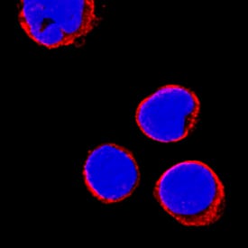 CD69 was detected in immersion fixed human peripheral blood mononuclear cells (PBMCs) using Mouse Anti-Human CD69 Monoclonal Antibody (Catalog # MAB2359) at 8 µg/mL for 3 hours at room temperature. Cells were stained using the NorthernLights™ 557-conjugated Anti-Mouse IgG Secondary Antibody (red; Catalog # NL007) and counterstained with DAPI (blue). Specific staining was localized to cell surfaces. View our protocol for Fluorescent ICC Staining of Non-adherent Cells.