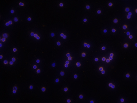 CD69 was detected in immersion fixed mouse splenocytes using 10 µg/mL Rat Anti-Mouse CD69 Monoclonal Antibody (Catalog # MAB23861) for 3 hours at room temperature. Cells were stained with the NorthernLights™ 557-conjugated Anti-Rat IgG Secondary Antibody (red; Catalog # NL013) and counterstained with DAPI (blue). View our protocol for Fluorescent ICC Staining of Non-adherent Cells.