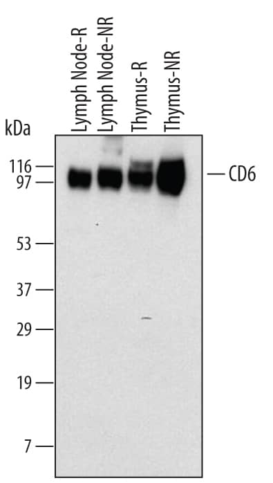 Detection of Mouse CD6 by Western Blot.Western blot shows lysates of mouse lymph node or thymus in reducing (R) or non-reducing (NR) sample buffer. PVDF membrane was probed with 2 µg/mL of Mouse CD6 Monoclonal Antibody (Catalog # MAB727) followed by HRP-conjugated Anti-Rat IgG Secondary Antibody (Catalog # HAF005). A specific band was detected for CD6 at approximately 100 kDa (as indicated). This experiment was conducted under reducing conditions and using Immunoblot Buffer Group 1.