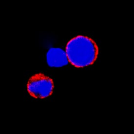 CD72 was detected in immersion fixed mouse splenocytes using Goat Anti-Mouse CD72 Antigen Affinity-purified Polyclonal Antibody (Catalog # AF1279) at 15 µg/mL for 3 hours at room temperature. Cells were stained using the NorthernLights™ 557-conjugated Anti-Goat IgG Secondary Antibody (red; Catalog # NL001) and counterstained with DAPI (blue). Specific staining was localized to cytoplasm and cell surfaces. View our protocol for Fluorescent ICC Staining of Non-adherent Cells.