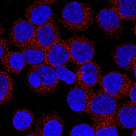 CD72 was detected in immersion fixed Ramos human Burkitt's lymphoma cell line using Mouse Anti-Human CD72 Monoclonal Antibody (Catalog # MAB5405) at 8 µg/mL for 3 hours at room temperature. Cells were stained using the NorthernLights™ 557-conjugated Anti-Mouse IgG Secondary Antibody (red; Catalog # NL007) and counterstained with DAPI (blue). Specific staining was localized to cytoplasm. View our protocol for Fluorescent ICC Staining of Non-adherent Cells.