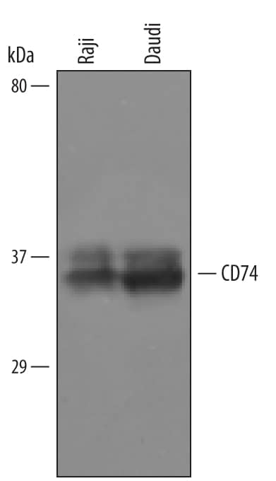 Western blot shows lysates of Raji human Burkitt's lymphoma cell line and Daudi human Burkitt's lymphoma cell line. PVDF Membrane was probed with 1 µg/mL of Human CD74 Antigen Affinity-purified Polyclonal Antibody (Catalog # AF3590) followed by HRP-conjugated Anti-Sheep IgG Secondary Antibody (Catalog # HAF016). A specific band was detected for CD74 at approximately 35 kDa (as indicated). This experiment was conducted under reducing conditions and using Immunoblot Buffer Group 8.