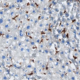 CD74 was detected in perfusion fixed frozen sections of mouse liver using Sheep Anti-Mouse CD74 Antigen Affinity-purified Polyclonal Antibody (Catalog # AF7478) at 1.7 µg/mL overnight at 4 °C. Tissue was stained using the Anti-Sheep HRP-DAB Cell & Tissue Staining Kit (brown; CTS019) and counter-stained with hematoxylin (blue). Specific staining was localized to stellate cells. View our protocol for Chromogenic IHC Staining of Frozen Tissue Sections.