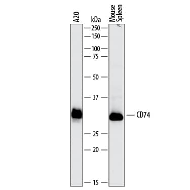 Western blot shows lysates of A20 mouse B cell lymphoma cell line and mouse spleen tissue. PVDF membrane was probed with 2 µg/mL of Sheep Anti-Mouse CD74 Antigen Affinity-purified Polyclonal Antibody (Catalog # AF7478) followed by HRP-conjugated Anti-Sheep IgG Secondary Antibody (HAF016). A specific band was detected for CD74 at approximately 31-34 kDa (as indicated). This experiment was conducted under reducing conditions and using Immunoblot Buffer Group 1.