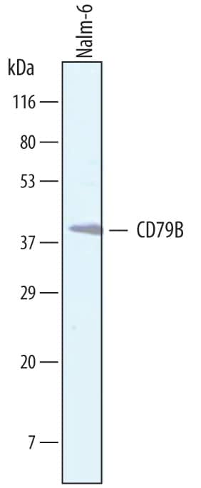 Western blot shows lysates of Nalm-6 human Pre-B acute lymphocytic leukemia cell line. PVDF membrane was probed with 0.5 µg/mL of Sheep Anti-Human CD79B Antigen Affinity-purified Polyclonal Antibody (Catalog # AF6620) followed by HRP-conjugated Anti-Sheep IgG Secondary Antibody (Catalog # HAF016). A specific band was detected for CD79B at approximately 40kDa (as indicated). This experiment was conducted under reducing conditions and using Immunoblot Buffer Group 8.