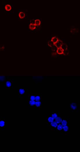 Immunocytochemistry CD79B Antibody