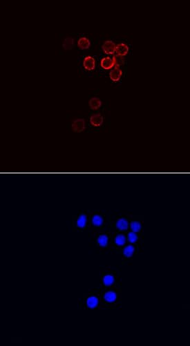 CD79B was detected in immersion fixed mouse splenocytes using Rat Anti-Mouse CD79B Monoclonal Antibody (Catalog # MAB6814) at 10 µg/mL for 3 hours at room temperature. Cells were stained using the NorthernLights™ 557-conjugated Anti-Rat IgG Secondary Antibody (red, upper panel; Catalog # NL013) and counterstained with DAPI (blue, lower panel). Specific staining was localized to cytoplasm. View our protocol for Fluorescent ICC Staining of Non-adherent Cells.