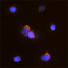 CD7 was detected in immersion fixed human peripheral blood mononuclear cells (PBMCs) using Sheep Anti-Human CD7 Antigen Affinity-purified Polyclonal Antibody (Catalog # AF7579) at 15 µg/mL for 3 hours at room temperature. Cells were stained using the Northern-Lights™ 557-conjugated Anti-Sheep IgG Secondary Antibody (red; Catalog # NL010) and counterstained with DAPI (blue). Specific staining was localized to cytoplasm and plasma membrane. View our protocol for Fluorescent ICC Staining of Cells on Coverslips.