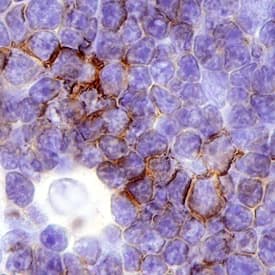 CD7 was detected in immersion fixed paraffin-embedded sections of human thymus using Sheep Anti-Human CD7 Antigen Affinity-purified Polyclonal Antibody (Catalog # AF7579) at 3 µg/mL overnight at 4 °C. Before incubation with the primary antibody, tissue was subjected to heat-induced epitope retrieval using Antigen Retrieval Reagent-Basic (Catalog # CTS013). Tissue was stained using the Anti-Sheep HRP-DAB Cell & Tissue Staining Kit (brown; Catalog # CTS019) and counterstained with hematoxylin (blue). Specific staining was localized to the plasma membrane. View our protocol for Chromogenic IHC Staining of Paraffin-embedded Tissue Sections.