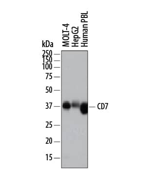 Western blot shows lysates of MOLT-4 human acute lymphoblastic leukemia cell line, HepG2 human hepatocellular carcinoma cell line, and human peripheral blood lymphocytes (PBL). PVDF membrane was probed with 0.5 µg/mL of Sheep Anti-Human CD7 Antigen Affinity-purified Polyclonal Antibody (Catalog # AF7579) followed by HRP-conjugated Anti-Sheep IgG Secondary Antibody (Catalog # HAF016). A specific band was detected for CD7 at approximately 35-40 kDa (as indicated). This experiment was conducted under reducing conditions and using Immunoblot Buffer Group 1.