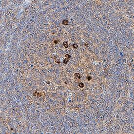 CD81 was detected in immersion fixed paraffin-embedded sections of human tonsil using Mouse Anti-Human CD81 Monoclonal Antibody (Catalog # MAB46151) at 5 µg/mL for 1 hour at room temperature followed by incubation with the Anti-Mouse IgG VisUCyte™ HRP Polymer Antibody (Catalog # VC001). Before incubation with the primary antibody, tissue was subjected to heat-induced epitope retrieval using Antigen Retrieval Reagent-Basic (Catalog # CTS013). Tissue was stained using DAB (brown) and counterstained with hematoxylin (blue). Specific staining was localized to cell surface. View our protocol for IHC Staining with VisUCyte HRP Polymer Detection Reagents.