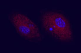 CD83 was detected in immersion fixed LPS-stimulated mouse dendritic cells using Goat Anti-Mouse CD83 Antigen Affinity-purified Polyclonal Antibody (Catalog # AF1437) at 10 µg/mL for 3 hours at room temperature. Cells were stained using the NorthernLights™ 557-conjugated Anti-Goat IgG Secondary Antibody (red; Catalog # NL001) and counterstained with DAPI (blue). View our protocol for Fluorescent ICC Staining of Non-adherent Cells.