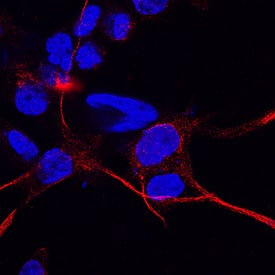 Immunocytochemistry CD83 Antibody (HB15e) [Unconjugated]