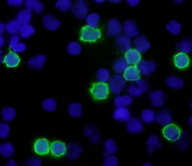 CD8a was detected in immersion fixed human peripheral blood mononuclear cells using Mouse Anti-Human CD8a Monoclonal Antibody (Catalog # MAB1509) at 10 µg/mL for 3 hours at room temperature. Cells were stained using the NorthernLights™ 493-conjugated Anti-Mouse IgG Secondary Antibody (green; Catalog # NL009) and counterstained with DAPI (blue). Specific staining was localized to cell surfaces. View our protocol for Fluorescent ICC Staining of Non-adherent Cells.