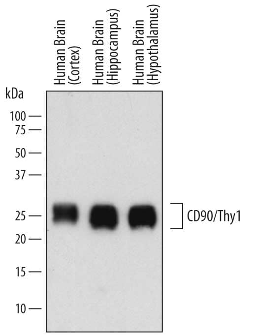 Western Blot CD90/Thy1 Antibody