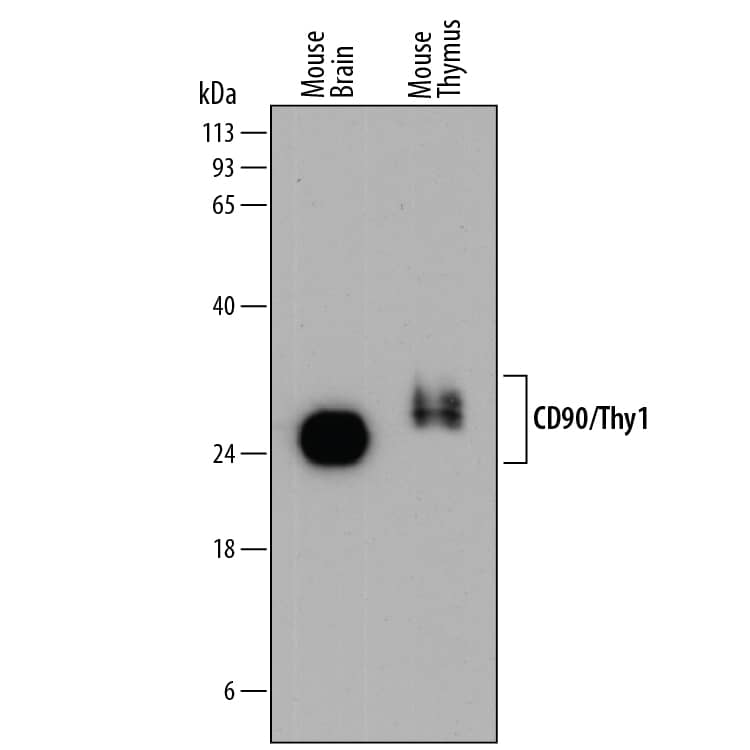 Western blot shows lysates of mouse brain tissue and mouse thymus tissue. PVDF membrane was probed with 0.5 µg/mL of Rat Anti-Mouse CD90/Thy1 Monoclonal Antibody (Catalog # MAB7335) followed by HRP-conjugated Anti-Rat IgG Secondary Antibody (Catalog # HAF005). Specific bands were detected for CD90/Thy1 at approximately 25-30 kDa (as indicated). This experiment was conducted under reducing conditions and using Immunoblot Buffer Group 1.