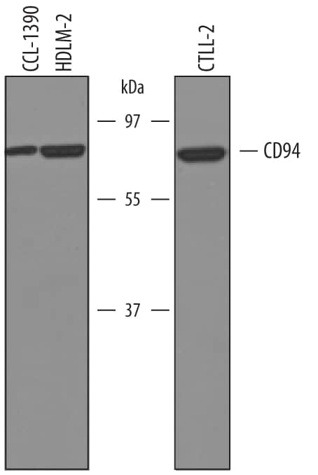 Western blot shows lysates of CLL-1390 canine leukocytic round cell neoplasia cell line, HDLM human Hodgkin’s lymphoma cell line, and CTLL-2 mouse cytotoxic T cell line. PVDF membrane was probed with 1 µg/mL of Sheep Anti-Human CD94 Antigen Affinity-purified Polyclonal Antibody (Catalog # AF1058) followed by HRP-conjugated Anti-Sheep IgG Secondary Antibody (Catalog # HAF016). A specific band was detected for CD94 at approximately 75 kDa (as indicated). This experiment was conducted under reducing conditions and using Immunoblot Buffer Group 8.