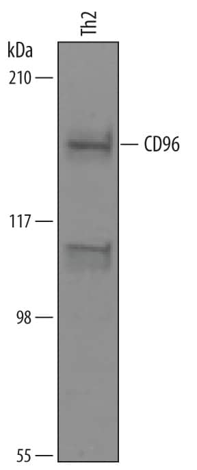 Western blot shows lysates of human Th2 cells. PVDF membrane was probed with 1 µg/mL of Sheep Anti-Human CD96 Antigen Affinity-purified Polyclonal Antibody (Catalog # AF6199) followed by HRP-conjugated Anti-Sheep IgG Secondary Antibody (Catalog # HAF016). A specific band was detected for CD96 at approximately 160 kDa (as indicated). This experiment was conducted under reducing conditions and using Immunoblot Buffer Group 8.