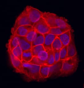 Immunocytochemistry CD99 Antibody [Unconjugated]