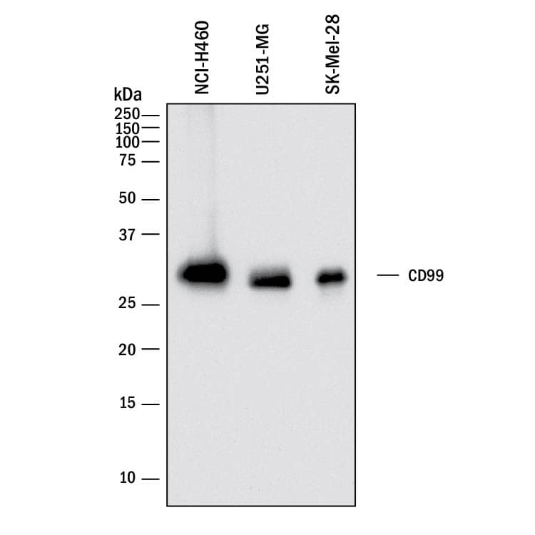 Western Blot CD99 Antibody [Unconjugated]