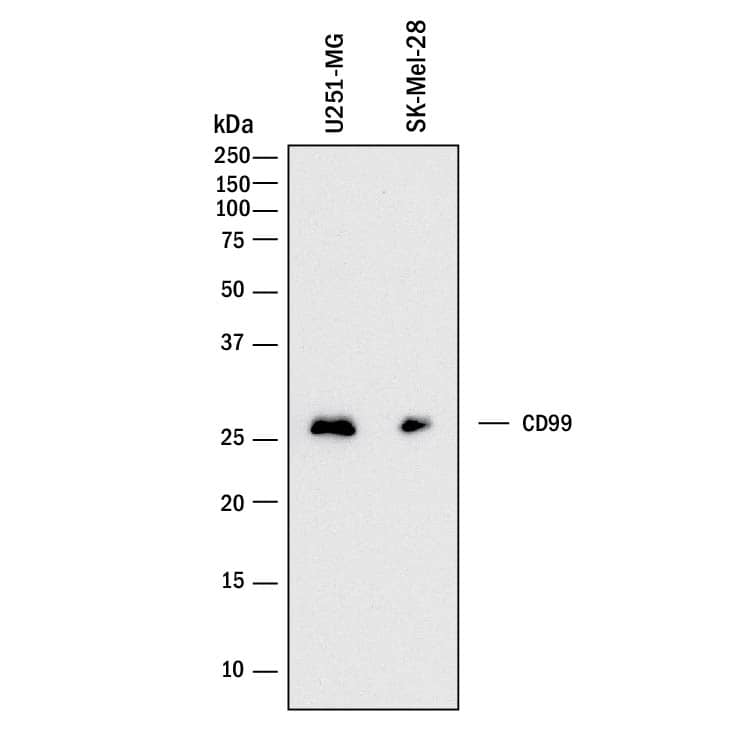Western blot shows lysates of U251-MG human malignant glioblastoma cell line and SK-Mel-28 human malignant melanoma cell line. PVDF membrane was probed with 2 µg/mL of Mouse Anti-Human CD99 Monoclonal Antibody (Catalog # MAB3968) followed by HRP-conjugated Anti-Mouse IgG Secondary Antibody (Catalog # HAF018). A specific band was detected for CD99 at approximately 30 kDa (as indicated). This experiment was conducted under reducing conditions and using Immunoblot Buffer Group 1.