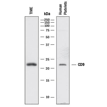 Western blot shows lysates of TIME human endothelial cell line and human platelets. PVDF membrane was probed with 2 µg/mL of Mouse Anti-Human CD9 Monoclonal Antibody (Catalog # MAB25292) followed by HRP-conjugated Anti-Mouse IgG Secondary Antibody (Catalog # HAF018). A specific band was detected for CD9 at approximately 24 kDa (as indicated). This experiment was conducted under reducing conditions and using Immunoblot Buffer Group 1.