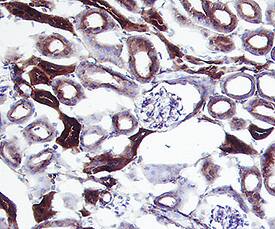 CD9 was detected in perfusion fixed frozen sections of mouse kidney using Rat Anti-Mouse CD9 Monoclonal Antibody (Catalog # MAB5218) at 25 µg/mL overnight at 4 °C. Tissue was stained using the Anti-Mouse HRP-DAB Cell & Tissue Staining Kit (brown; Catalog # CTS002) and counterstained with hematoxylin (blue). Specific staining was localized to cytoplasm in convoluted tubules. View our protocol for Chromogenic IHC Staining of Paraffin-embedded Tissue Sections.