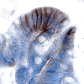 CDCP1 was detected in immersion fixed paraffin-embedded sections of human colon cancer tissue using Goat Anti-Human CDCP1 Antigen Affinity-purified Polyclonal Antibody (Catalog # AF2666) at 15 µg/mL overnight at 4 °C. Tissue was stained using the Anti-Goat HRP-DAB Cell & Tissue Staining Kit (brown; Catalog # CTS008) and counterstained with hematoxylin (blue). Specific labeling was localized to the apices of colonic villi. View our protocol for Chromogenic IHC Staining of Paraffin-embedded Tissue Sections.