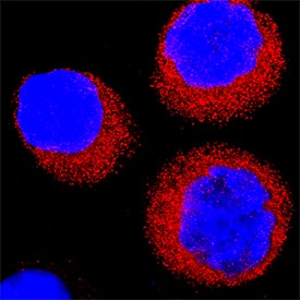 Immunocytochemistry CDK2 Antibody [Unconjugated]