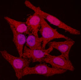 Immunocytochemistry CDK4 Antibody [Unconjugated]