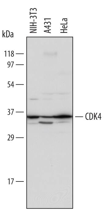 Western Blot CDK4 Antibody [Unconjugated]