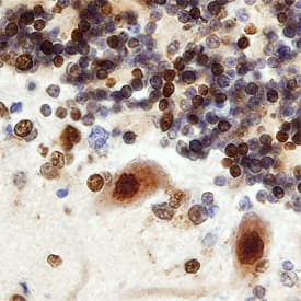 Immunohistochemistry CDK5 Activator 1 Antibody