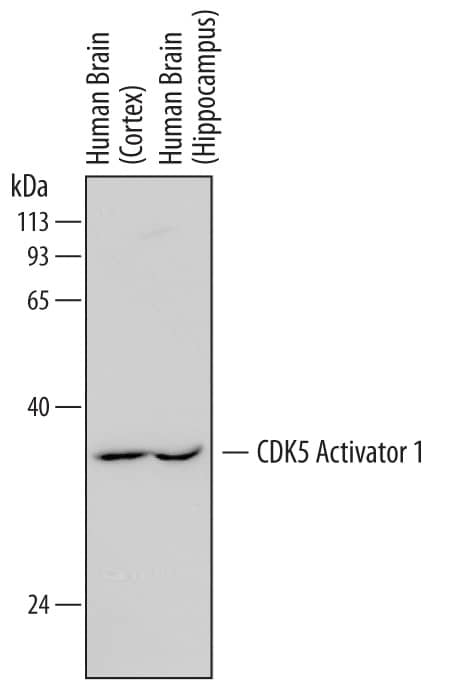 Western Blot CDK5 Activator 1 Antibody (739304)