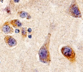 CDNF was detected in immersion fixed paraffin-embedded sections of human brain (cortex) using 10 µg/mL Goat Anti-Human CDNF Antigen Affinity-purified Polyclonal Antibody (Catalog # AF5097) overnight at 4 °C. Before incubation with the primary antibody tissue was subjected to heat-induced epitope retrieval using Antigen Retrieval Reagent-Basic (Catalog # CTS013). Tissue was stained with the Anti-Goat HRP-DAB Cell & Tissue Staining Kit (brown; Catalog # CTS008) and counterstained with hematoxylin (blue). View our protocol for Chromogenic IHC Staining of Paraffin-embedded Tissue Sections.