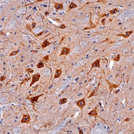 CDNF was detected in perfusion fixed frozen sections of mouse brain (medulla) using Goat Anti-Mouse CDNF Antigen Affinity-purified Polyclonal Antibody (Catalog # AF5187) at 5 µg/mL overnight at 4 °C. Tissue was stained using the Anti-Goat HRP-DAB Cell & Tissue Staining Kit (brown; Catalog # CTS008) and counterstained with hematoxylin (blue). Specific staining was localized to neuronal cell bodies and processes. View our protocol for Chromogenic IHC Staining of Frozen Tissue Sections.