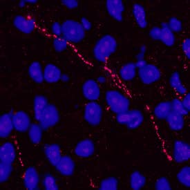CDNF was detected in perfusion fixed frozen sections of mouse brain using Rat Anti-Mouse CDNF Monoclonal Antibody (Catalog # MAB5187) at 25 µg/mL overnight at 4 °C. Tissue was stained using the NorthernLights™ 557-conjugated Anti-Rat IgG Secondary Antibody (red; Catalog # NL013) and counterstained with DAPI (blue). Specific staining was localized to neuronal processes. View our protocol for Fluorescent IHC Staining of Frozen Tissue Sections.
