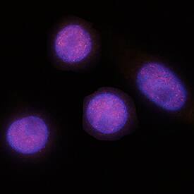 CDX2 was detected in immersion fixed SW480 human colorectal adenocarcinoma cell line using Mouse Anti-Human CDX2 Monoclonal Antibody (Catalog # MAB3665) at 8 µg/mL for 3 hours at room temperature. Cells were stained using the NorthernLights™ 557-conjugated Anti-Mouse IgG Secondary Antibody (red; Catalog # NL007) and counterstained with DAPI (blue). Specific staining was localized to nuclei. View our protocol for Fluorescent ICC Staining of Cells on Coverslips.