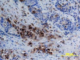 Immunohistochemistry CEACAM1/CD66a Antibody (283324) [Unconjugated]